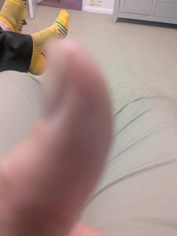 My thumb as a photo is needed in order to submit a review