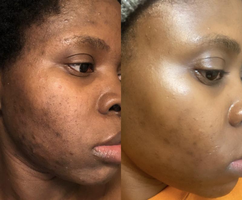Before and After (Still in progress)