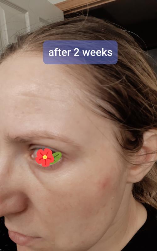 After 2 weeks of using