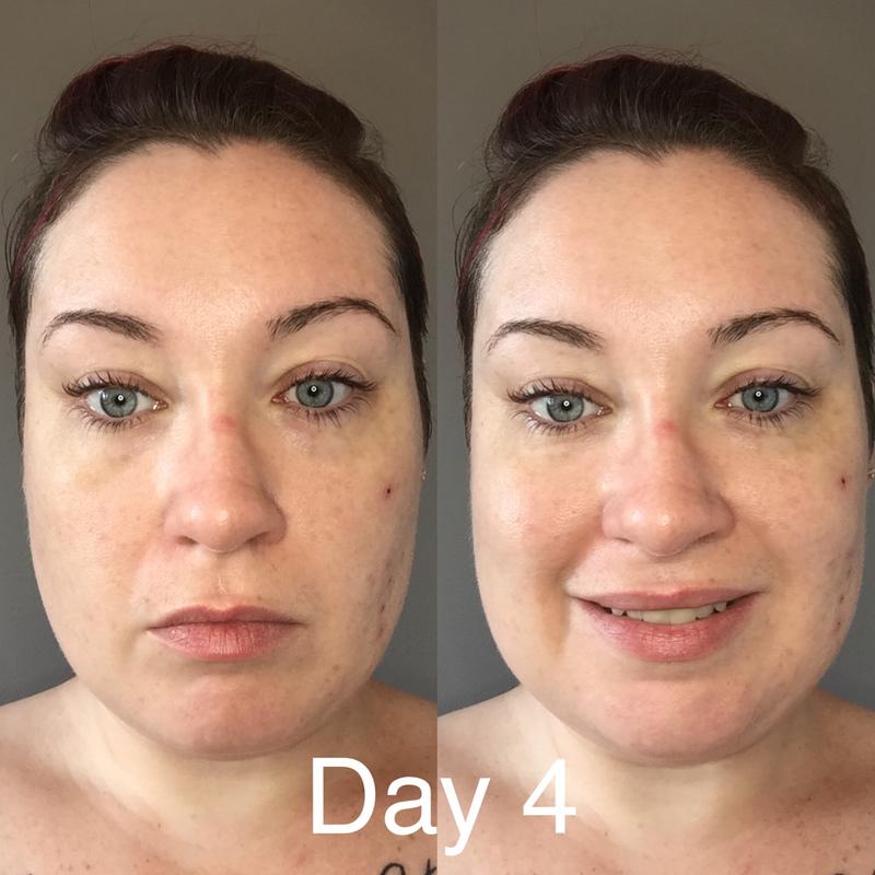 Day four