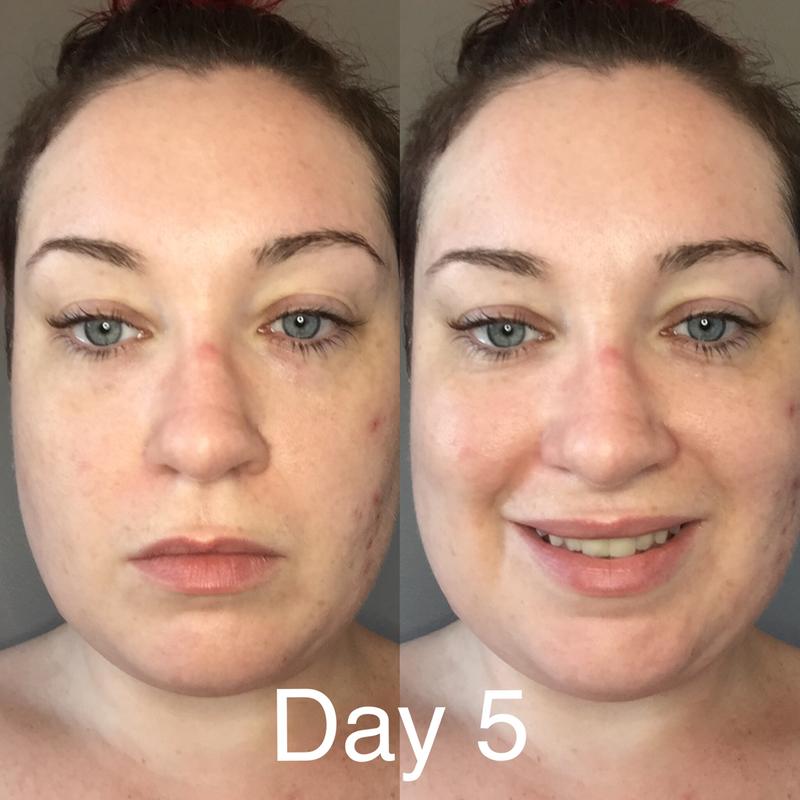 Day five