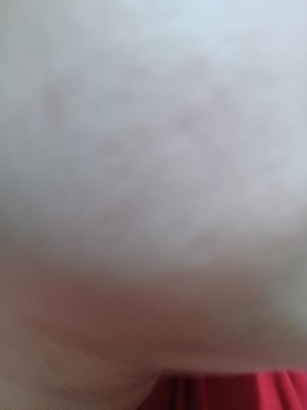 Die haut