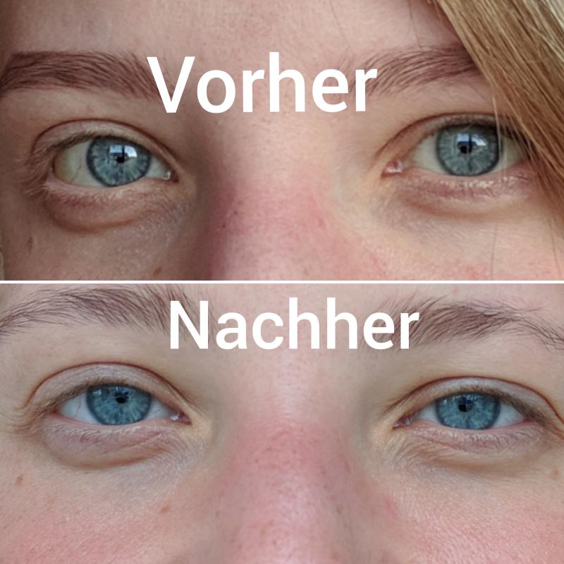 Vorher/Nachher