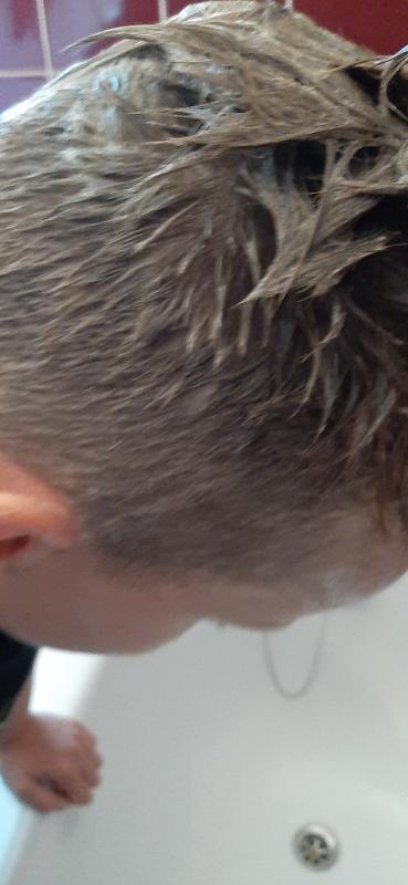 Beim benutzen des Vichy Anti-Schuppen DS Intensiv Shampoo