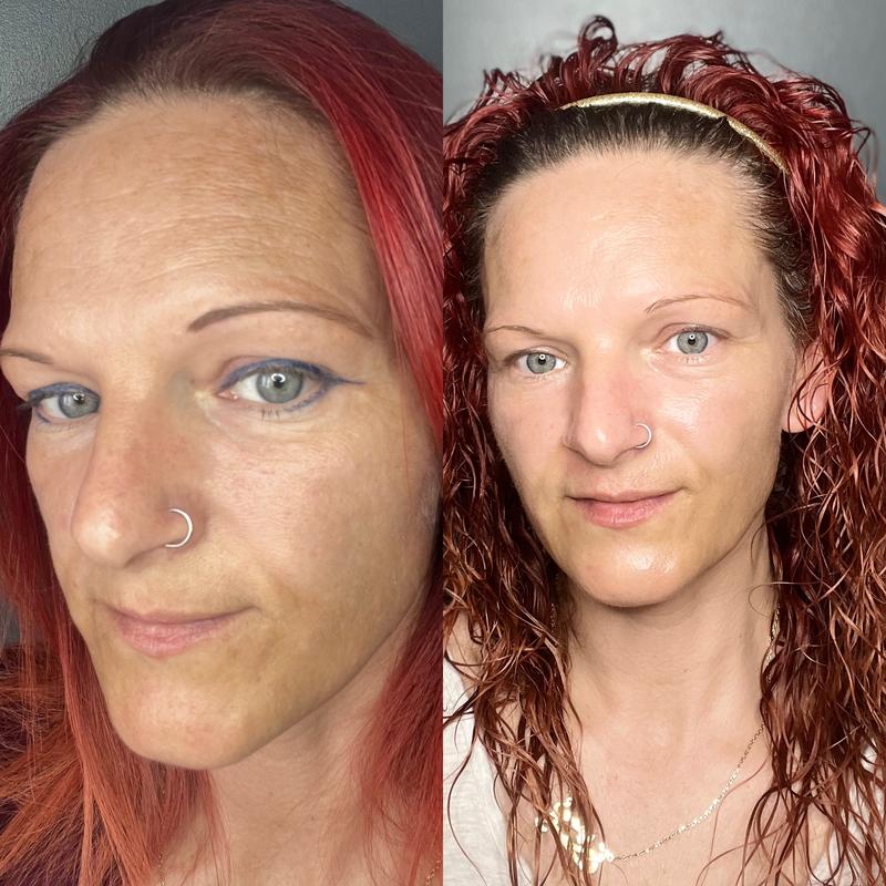 Before and after photo