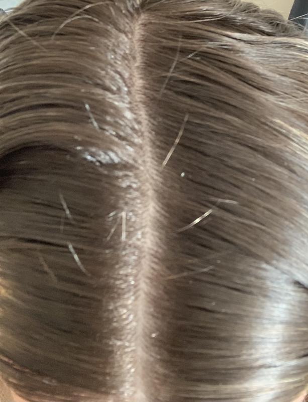 Left my scalp flake free