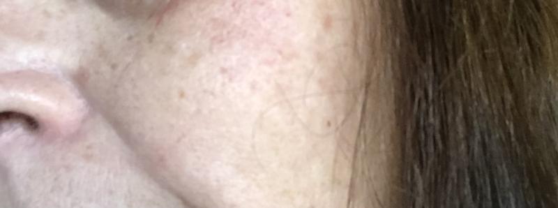 My skin with Liftactive B3 Serum