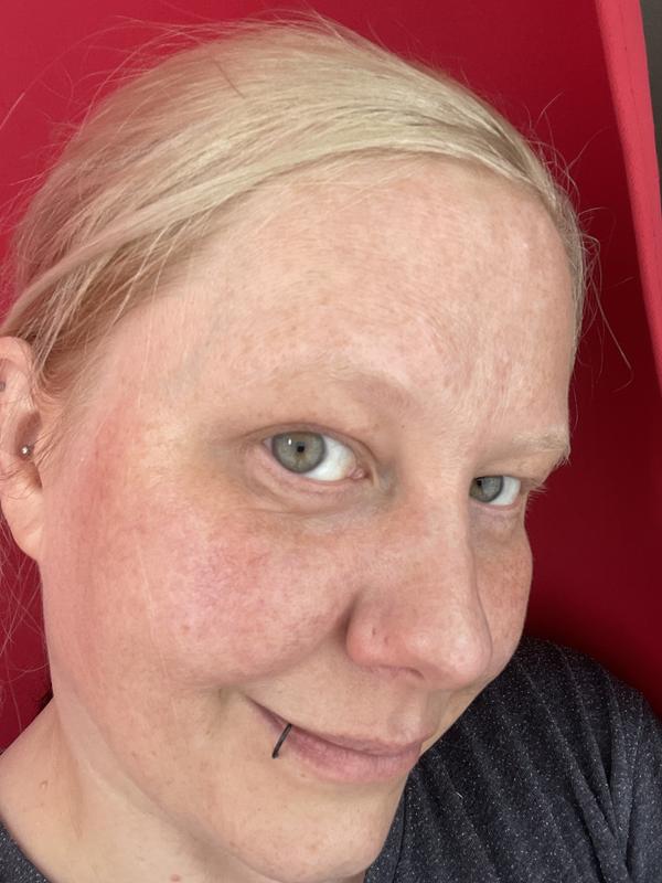 My skin after just one application