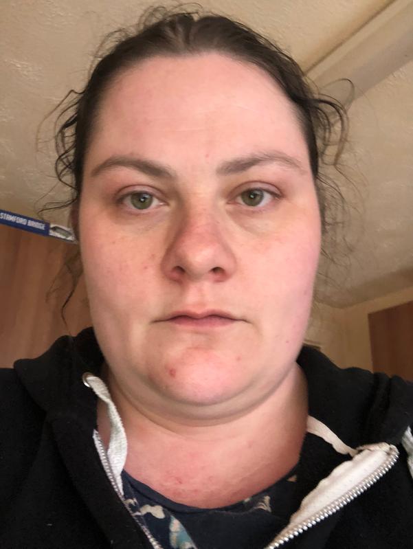 dermablend color corrector