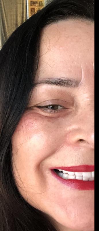 Me using Retinol Specialist Deep Wrinkle Serum at night and the result the next morning!