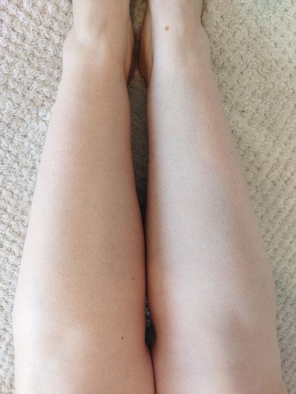 Avis sur la photo 1.